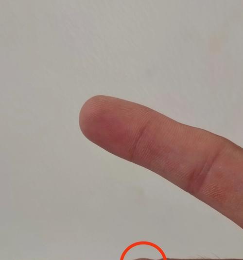 拿手机拍照时拇指中指疼痛原因是什么？
